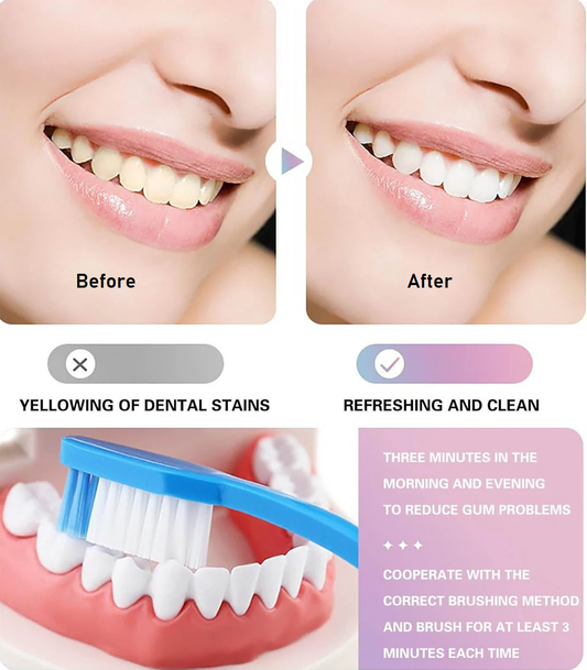 Nicotinamide Dazzle White Toothpaste