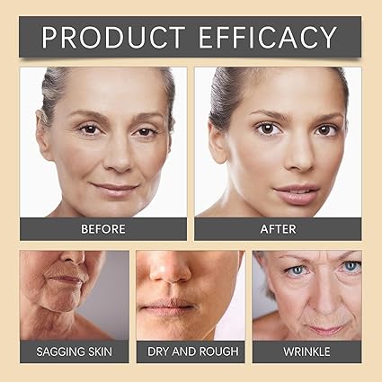 Bee Venom Botox Wrinkle Cream - Look Young