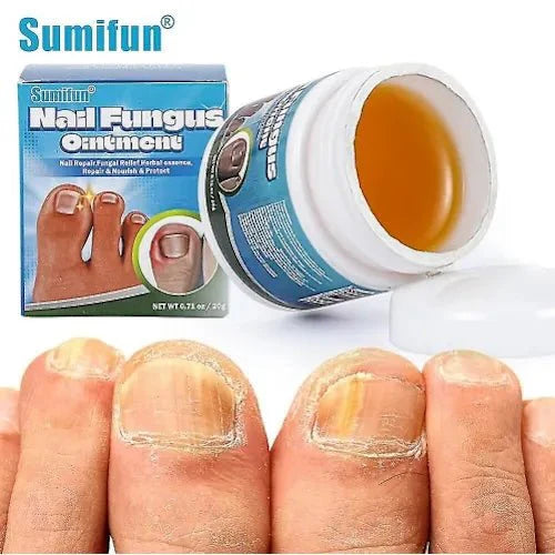 Nail Fungus Ointment